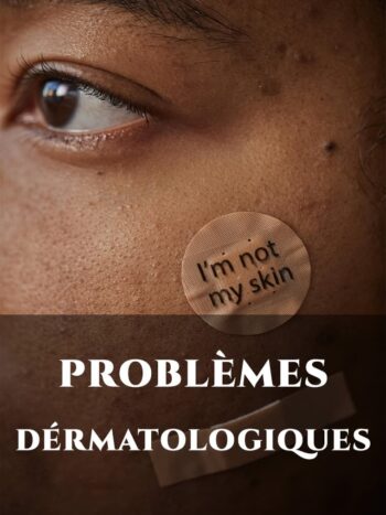 PROBLEMES DERMATOLOGIQUES