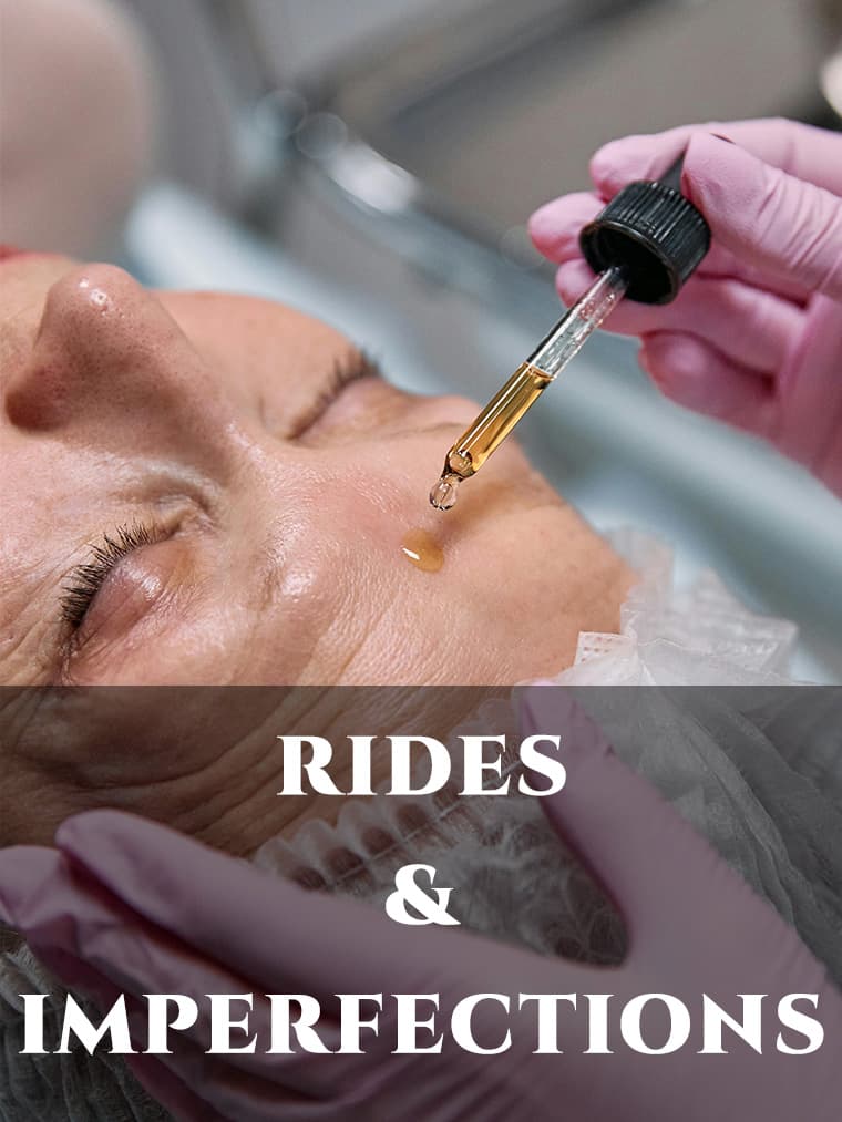 RIDES & IMPERFECTIONS